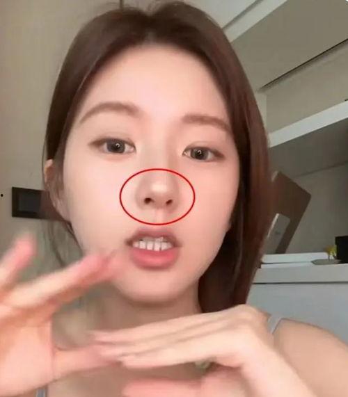 缩小鼻翼视频,打造精致鼻型教程